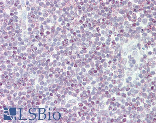 Anti-HOXB6 antibody IHC staining of human tonsil. Immunohistochemistry of formalin-fixed, paraffin-embedded tissue after heat-induced antigen retrieval.
