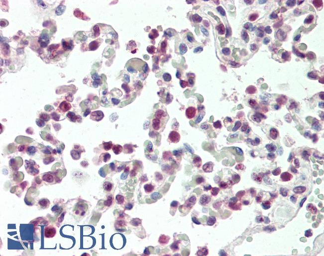 Anti-HOXB6 antibody IHC staining of human lung. Immunohistochemistry of formalin-fixed, paraffin-embedded tissue after heat-induced antigen retrieval. Antibody LS-B10574 concentration 5 ug/ml.