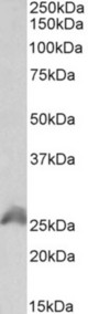 HOXB6 antibody (1 ug/ml) staining of HEK293 lysate (35 ug protein in RIPA buffer). Primary incubation was 1 hour. Detected by chemiluminescence.