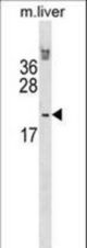 Mouse Hoxb6 Antibody western blot of mouse liver tissue lysates (35 ug/lane). The Hoxb6 antibody detected the Hoxb6 protein (arrow).