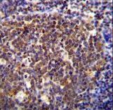 HOXB6 Antibody immunohistochemistry of formalin-fixed and paraffin-embedded human tonsil tissue followed by peroxidase-conjugated secondary antibody and DAB staining.