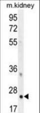 HOXB6 Antibody western blot of mouse kidney tissue lysates (35 ug/lane). The HOXB6 antibody detected the HOXB6 protein (arrow).