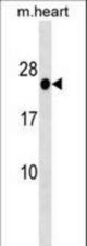 HOXB7 Antibody western blot of mouse heart tissue lysates (35 ug/lane). The HOXB7 antibody detected the HOXB7 protein (arrow).