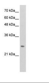 Transfected 293T Cell Lysate