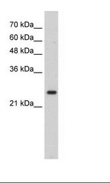 Transfected 293T Cell Lysate