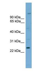 HOXB7 antibody Western Blot of NIH3T3.