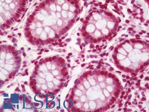 Anti-HOXB7 antibody IHC staining of human colon. Immunohistochemistry of formalin-fixed, paraffin-embedded tissue after heat-induced antigen retrieval. Antibody LS-B11207 dilution 1:100.
