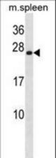 Mouse Hoxb7 Antibody western blot of mouse spleen tissue lysates (35 ug/lane). The Hoxb7 antibody detected the Hoxb7 protein (arrow).