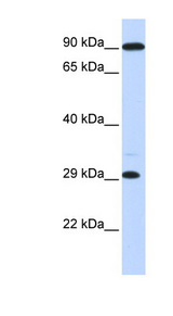 HOXB8 antibody LS-C101594 Western blot of Fetal Muscle lysate.