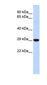 HOXB8 antibody LS-C101780 Western blot of Fetal Liver lysate.