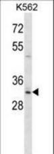 Mouse Hoxb8 Antibody western blot of K562 cell line lysates (35 ug/lane). The Hoxb8 antibody detected the Hoxb8 protein (arrow).
