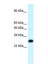 HOXB9 antibody LS-C145766 Western blot of Mouse Thymus lysate. Antibody concentration 1 ug/ml.