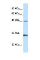 HOXB9 antibody LS-C145425 Western blot of Rat Muscle lysate. Antibody concentration 1 ug/ml.