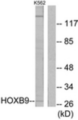 Western blot of extracts from K562 cells, using HOXB9 Antibody. The lane on the right is treated with the synthesized peptide.