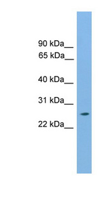 HOXB9 antibody LS-C116006 Western blot of Mouse Kidney lysate.