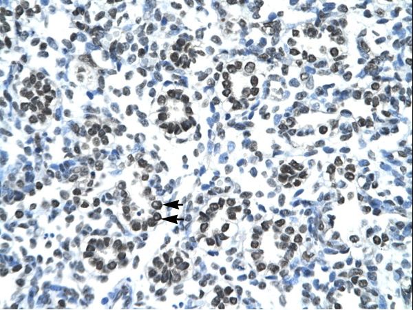 HOXB9 antibody LS-C29737 was used in IHC to stain formalin-fixed, paraffin-embedded human lung.