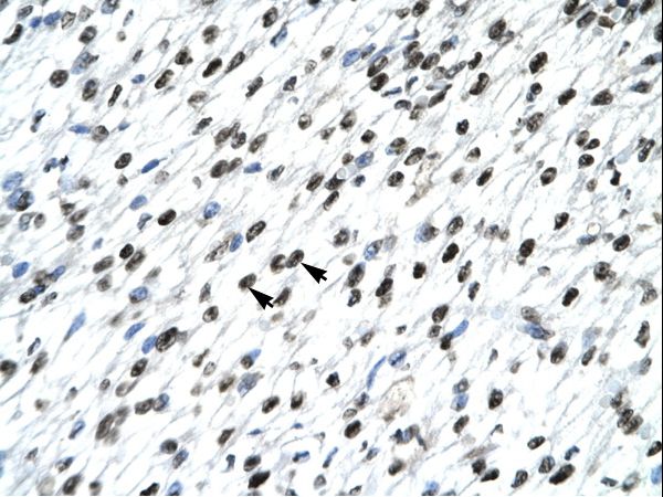 HOXB9 antibody LS-C29737 was used in IHC to stain formalin-fixed, paraffin-embedded human heart.