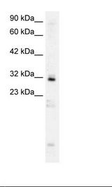 HepG2 Cell Lysate