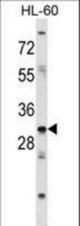 HOXB9 Antibody western blot of HL-60 cell line lysates (35 ug/lane). The HOXB9 antibody detected the HOXB9 protein (arrow).