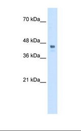 Transfected 293T cell lysate. Antibody concentration: 0.5 ug/ml. Gel concentration: 12%.