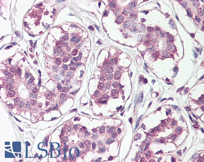 Anti-HOXC10 antibody IHC of human breast. Immunohistochemistry of formalin-fixed, paraffin-embedded tissue after heat-induced antigen retrieval. Antibody LS-B8075 dilution 5-10 ug/ml.