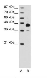 A: Marker, B: Transfected 293T Cell Lysate