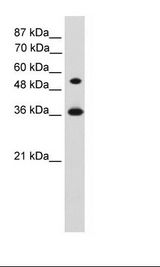 Transfected 293T Cell Lysate