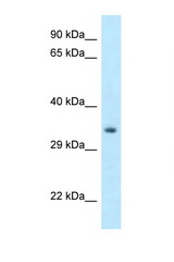 HOXC11 antibody LS-C145914 Western blot of Mouse Pancreas lysate. Antibody concentration 1 ug/ml.