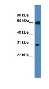 HOXC12 antibody LS-C135090 Western blot of ACHN lysate.
