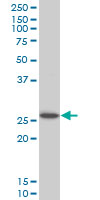 HOXC12 monoclonal antibody (M01), clone 1C6 Western Blot analysis of HOXC12 expression in Jurkat.