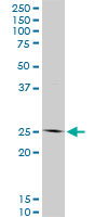 HOXC12 monoclonal antibody (M01), clone 1C6. Western Blot analysis of HOXC12 expression in NIH/3T3.