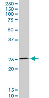 HOXC12 monoclonal antibody (M01), clone 1C6. Western Blot analysis of HOXC12 expression in PC-12.