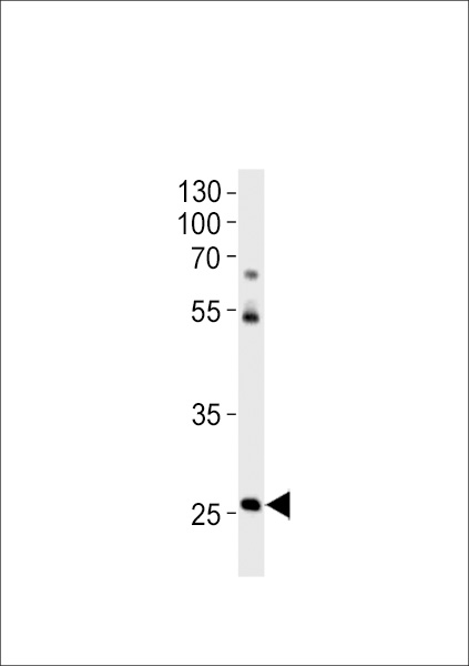 DANRE hoxc4a Antibody western blot of zebra fish brain tissue lysates (35 ug/lane). The DANRE hoxc4a antibody detected the DANRE hoxc4a protein (arrow).