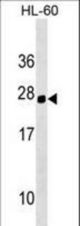 Mouse Hoxc5 Antibody western blot of HL-60 cell line lysates (35 ug/lane). The Hoxc5 antibody detected the Hoxc5 protein (arrow).