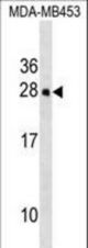 Mouse Hoxc5 Antibody western blot of MDA-MB453 cell line lysates (35 ug/lane). The Hoxc5 antibody detected the Hoxc5 protein (arrow).