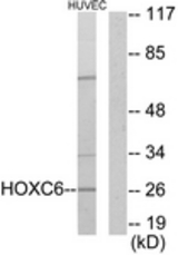 Western blot of extracts from HUVEC cells, using HOXC6 Antibody. The lane on the right is treated with the synthesized peptide.