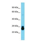 Western blot of Rat Small Intestine. Hoxc6 antibody dilution 1.0 ug/ml.