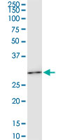 HOXC6 monoclonal antibody (M04), clone 2A4. Western Blot analysis of HOXC6 expression in HeLa NE.