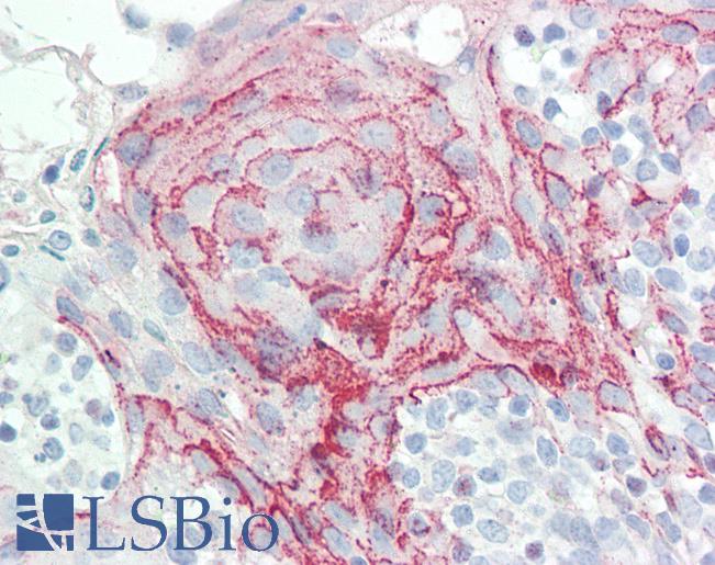 Anti-HOXC6 antibody IHC staining of human tonsil. Immunohistochemistry of formalin-fixed, paraffin-embedded tissue after heat-induced antigen retrieval. Antibody LS-B10577 concentration 5 ug/ml.