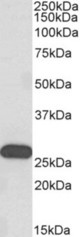 HOXC6 antibody (0.3 ug/ml) staining of Human Olfactory bulb lysate (35 ug protein in RIPA buffer). Primary incubation was 1 hour. Detected by chemiluminescence.