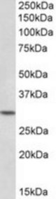HOXC8 antibody (0.1 ug/ml) staining of Peripheral Blood Lymphocytes lysate (35 ug protein/ml in RIPA buffer). Primary incubation was 1 hour. Detected by chemiluminescence.