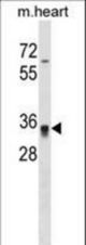 Mouse Hoxc8 Antibody western blot of mouse heart tissue lysates (35 ug/lane). The Hoxc8 antibody detected the Hoxc8 protein (arrow).