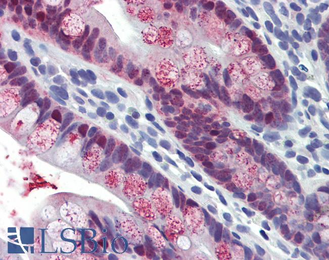 Anti-HOXC8 antibody IHC of human small intestine. Immunohistochemistry of formalin-fixed, paraffin-embedded tissue after heat-induced antigen retrieval. Antibody LS-B4004 concentration 5 ug/ml.
