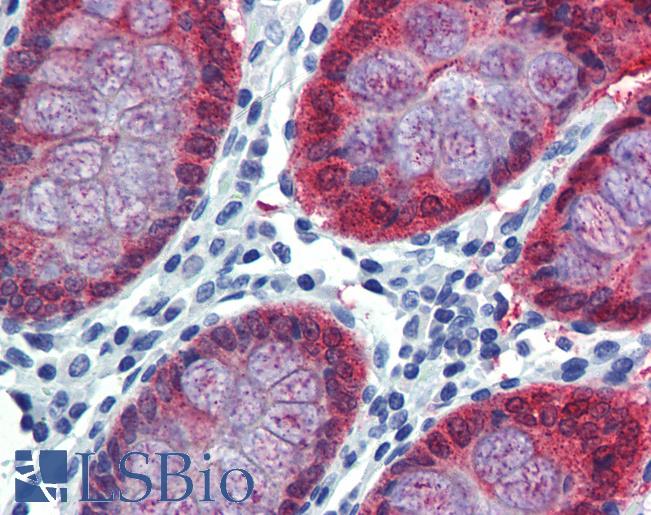 Anti-HOXC8 antibody IHC of human colon. Immunohistochemistry of formalin-fixed, paraffin-embedded tissue after heat-induced antigen retrieval. Antibody LS-B4004 concentration 5 ug/ml.