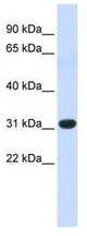 Western analysis of fetal muscle lysate.