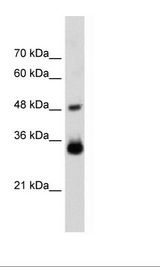 Transfected 293T Cell Lysate