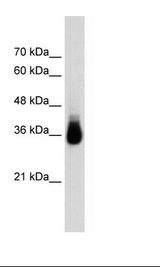 Transfected 293T Cell Lysate