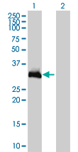 Western Blot analysis of HOXC9 expression in transfected 293T cell line by HOXC9 monoclonal antibody (M01), clone 2B12.Lane 1: HOXC9 transfected lysate(29.9 KDa).Lane 2: Non-transfected lysate.