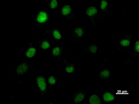 Immunostaining analysis in HT1080 cells. HT1080 cells were fixed with 4% paraformaldehyde and permeabilized with 0.1% Triton X-100 in PBS. The cells were immunostained with anti-HOXC9 mAb.