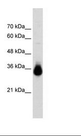 Transfected 293T Cell Lysate